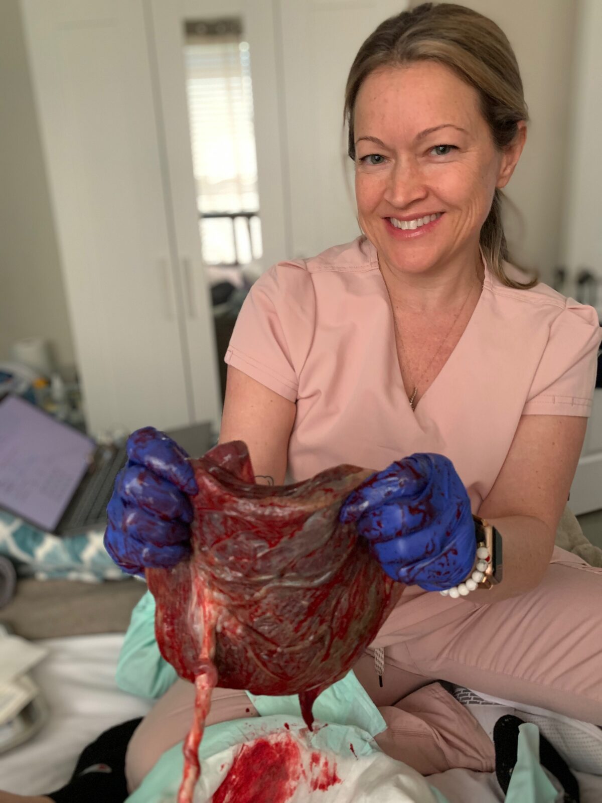 Rhonda showing a placenta during the postpartum check